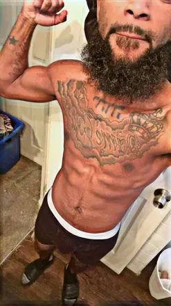 OnlyFans cuenta vitiligostar avatar 1