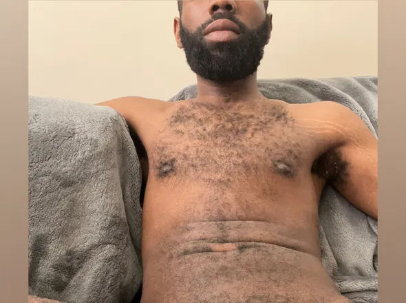 OnlyFans account  treeko323 header 2