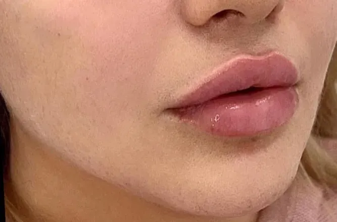 OnlyFans cuenta blossomingbabe avatar 1
