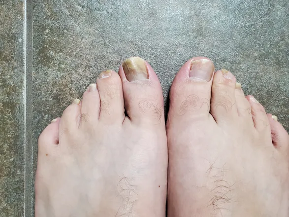 OnlyFans cuenta nastyfeet10 header 2
