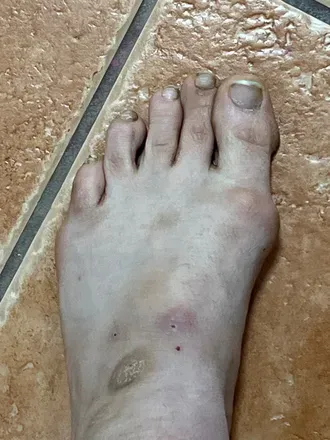 OnlyFans cuenta fckngdisgustingfeet avatar 1