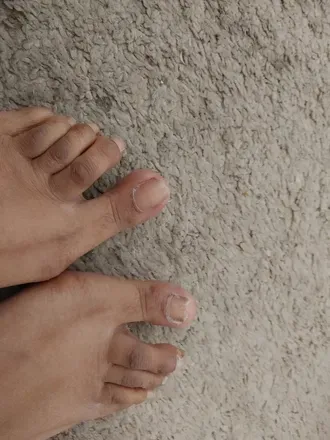 OnlyFans cuenta hammertoes0024 avatar 1