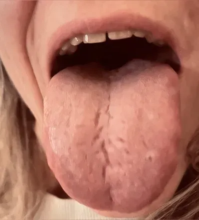 OnlyFans cuenta poppyslongtongue avatar 1