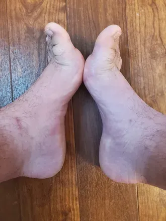 OnlyFans cuenta hopfeet avatar 1